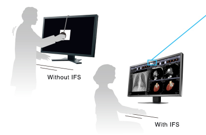 Manage Effortless Quality Control