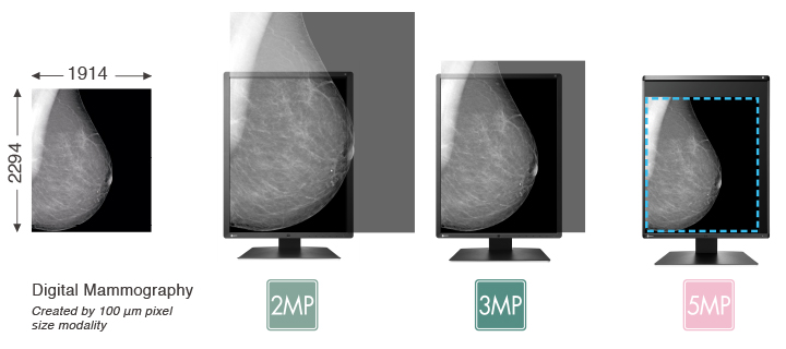 View Mammography Images Clearly