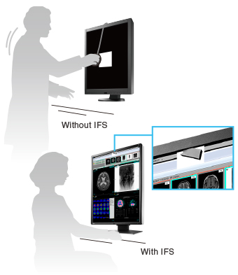 Manage Effortless Quality Control