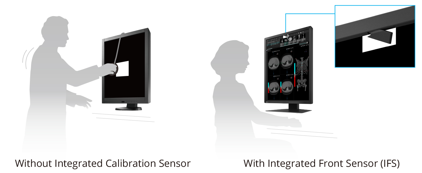 Manage Effortless Calibration