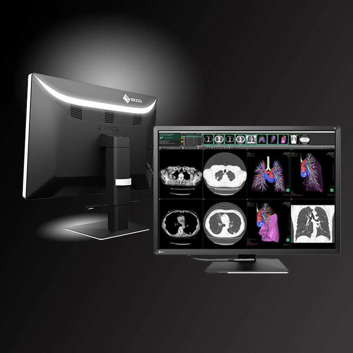 Medical grade display monitor