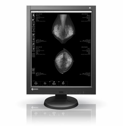 Mammography: Changing the Mammographic imaging paradigm