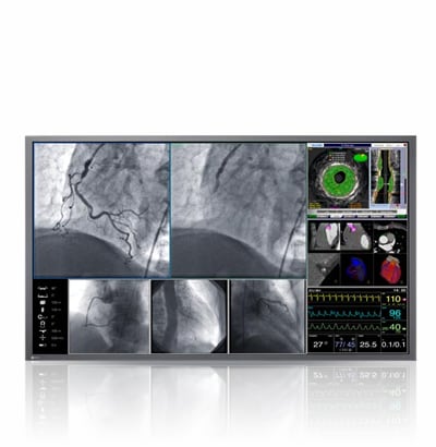 Surgery & Endoscopies: High-speed imaging for endoscopy, surgery, cardiac imaging and ultrasound