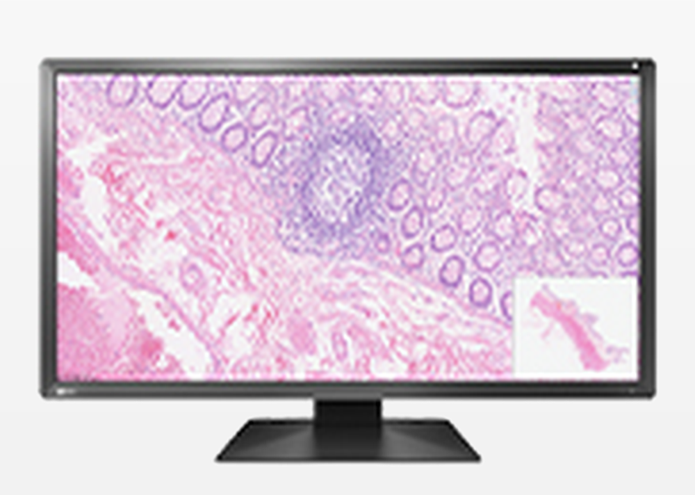 PX2150 Pathology Monitor
